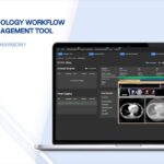 Development of a tool for managing radiology workflow